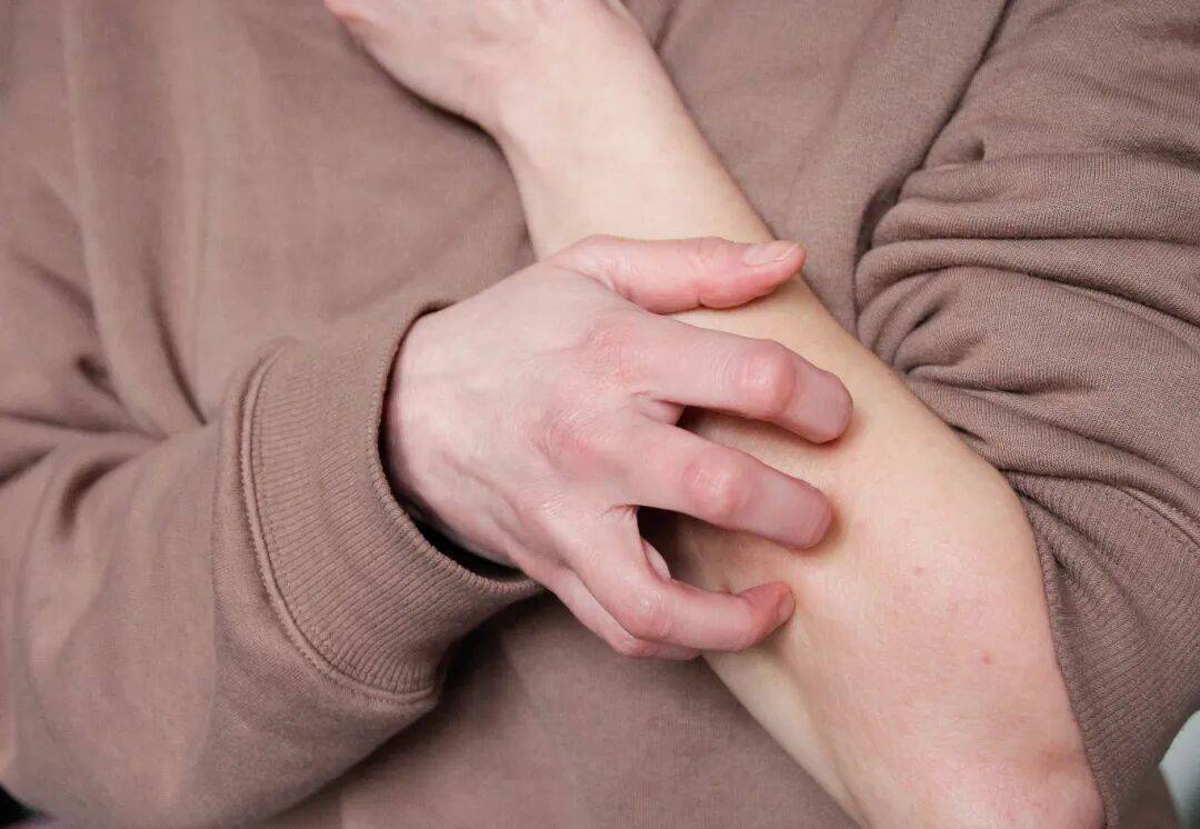 皇冠信用網是什么意思_事发上海街头！女子突然浑身肿胀皇冠信用網是什么意思，陷入昏迷...医生：建议随身携带肾上腺激素笔