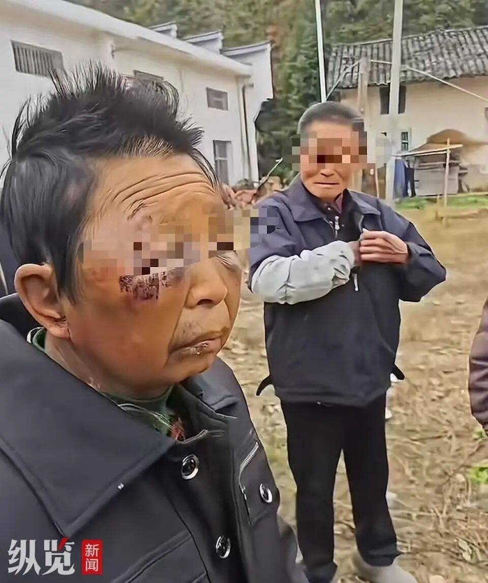 皇冠信用网开号
_湖南一女子被75岁丈夫酒后两次家暴皇冠信用网开号
，村民：女子被打从不还手，男子动手不是一次两次