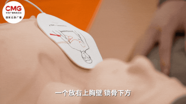 皇冠信用盘网址_山东一市民突发心梗皇冠信用盘网址，其家属砸窗取出陌生人车内AED用于急救；车主回应：砸就砸吧，人命比玻璃重要