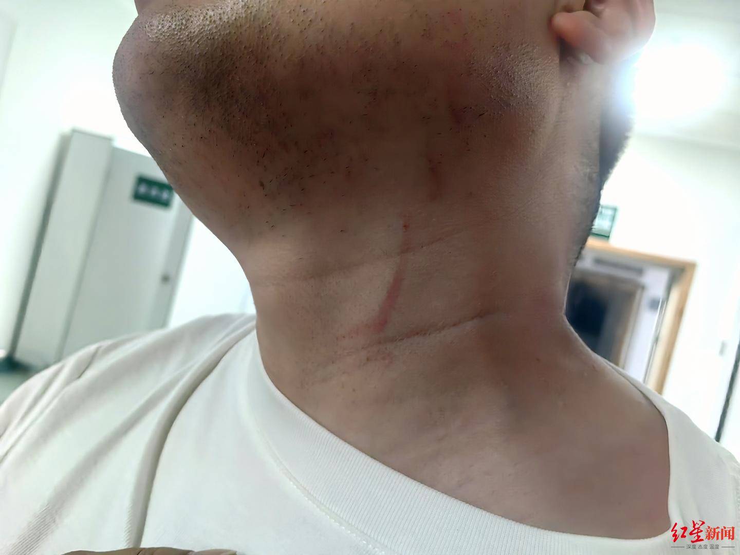 信用平台出租
_武汉男子拍摄违停时被当街殴打信用平台出租
，打人者被罚款500元，被打者称将提起行政复议并起诉
